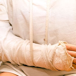 A woman with a cast on her arm, indicating an injury - Leep Tescher Helfman and Zanze